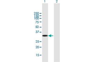 Western Blot analysis of UCP2 expression in transfected 293T cell line by UCP2 MaxPab polyclonal antibody. (UCP2 Antikörper  (AA 1-309))