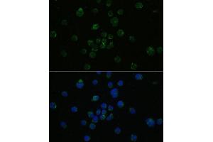 Immunofluorescence analysis of Jurkat cells using CD4 antibody (ABIN6132069, ABIN6138186, ABIN6138188 and ABIN6213820) at dilution of 1:100.