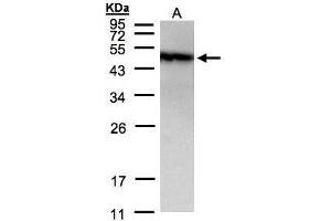WB Image Sample(30 μg of whole cell lysate) A:A431, 12% SDS PAGE antibody diluted at 1:1500 (GOPC Antikörper  (C-Term))