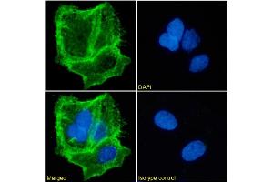 Immunofluorescence staining of Caco-2 cells using anti-EpCAM. (Rekombinanter EpCAM Antikörper)