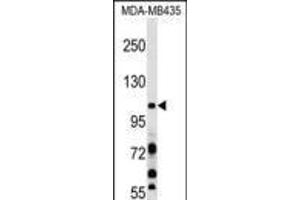 Western blot analysis in MDA-MB435 cell line lysates (35ug/lane). (PIK3CB Antikörper  (N-Term))