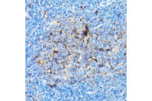 Immunohistochemistry of paraffin-embedded mouse spleen using SI antibody (ABIN3016131, ABIN3016132, ABIN3016133 and ABIN6219568) at dilution of 1:100 (40x lens). (SIAH1 Antikörper  (AA 1-313))