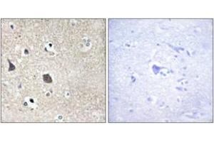 Immunohistochemistry analysis of paraffin-embedded human brain tissue, using TRI18 Antibody. (MID1 Antikörper  (AA 71-120))