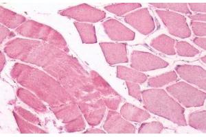 Human Skeletal Muscle: Formalin-Fixed, Paraffin-Embedded (FFPE) (UCHL3 Antikörper  (Internal Region))