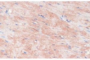 Immunohistochemistry of paraffin-embedded Rat heart using RPIA Polyclonal Antibody at dilution of 1:100 (40x lens). (Ribose 5-Phosphate Isomerase A (RPIA) Antikörper)