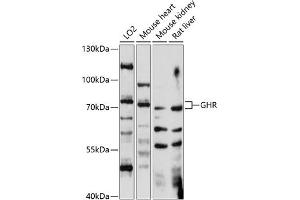 Western blot analysis of extracts of various cell lines, using GHR antibody (ABIN7267519) at 1:1000 dilution. (Growth Hormone Receptor Antikörper  (AA 26-260))