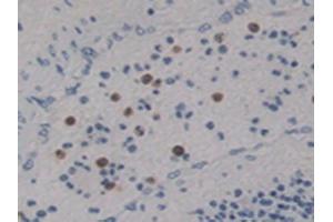 Figure. (Netrin 4 Antikörper  (AA 349-592))