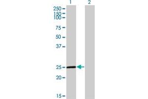 Western Blotting (WB) image for anti-Twist Homolog 1 (Drosophila) (TWIST1) (AA 100-202) antibody (ABIN521166)
