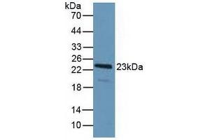 Western blot analysis of Human HeLa cells. (PDCD6 Antikörper  (AA 32-191))