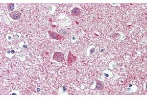 Detection of SYNPO in Human Cerebrum Tissue using Polyclonal Antibody to Synaptopodin (SYNPO) (SYNPO Antikörper  (AA 97-300))