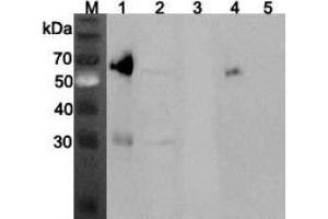 Western blot analysis using anti-ANGPTL3 (mouse), pAb  at 1:2'000 dilution. (ANGPTL3 Antikörper)