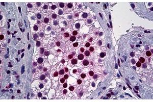 Human, Testis: Formalin-Fixed Paraffin-Embedded (FFPE) (YY1 Antikörper  (AA 221-321))