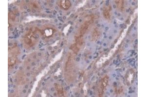 Detection of AT in Rat Kidney Tissue using Polyclonal Antibody to Antithrombin (AT) (SERPINC1 Antikörper  (AA 33-465))