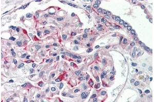 Human Kidney (formalin-fixed, paraffin-embedded) stained with JAG1 antibody ABIN337168 at 5 ug/ml followed by biotinylated goat anti-rabbit IgG secondary antibody ABIN481713, alkaline phosphatase-streptavidin and chromogen. (JAG1 Antikörper  (AA 110-125))