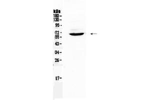 Western blot analysis of Heparanase 1 using anti-Heparanase 1 antibody . (HPSE Antikörper  (AA 206-457))