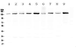 Western blot analysis of HAUSP/USP7 using anti-HAUSP/USP7 antibody .