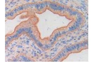 Figure. (FGF6 Antikörper  (AA 39-208))