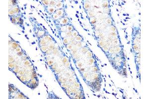 Immunohistochemistry of paraffin-embedded human colon using MUC2 Rabbit mAb (ABIN7268689) at dilution of 1:100 (40x lens). (MUC2 Antikörper)