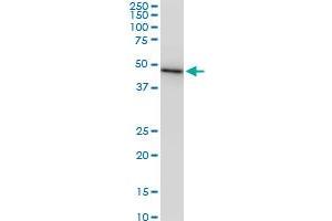 CMAS monoclonal antibody (M05), clone 2E1. (CMAS Antikörper  (AA 164-263))