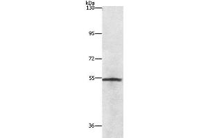 Western Blot analysis of Lovo cell using NEK2 Polyclonal Antibody at dilution of 1:727 (NEK2 Antikörper)
