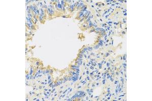 Immunohistochemistry of paraffin-embedded mouse lung using IL22 antibody at dilution of 1:100 (40x lens).