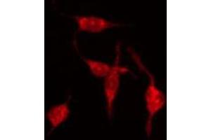 ABIN6273889 staining Hela by IF/ICC. (GPR68 Antikörper  (Internal Region))
