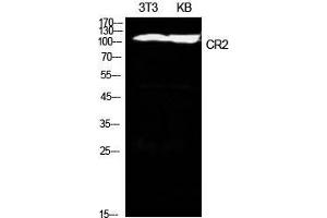 Western Blot (WB) analysis of NIH-3T3, KB cells using CD21 Polyclonal Antibody. (CD21 Antikörper  (Internal Region))