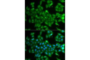 Immunofluorescence analysis of A549 cells using ANXA11 antibody. (Annexin A11 Antikörper  (AA 276-505))
