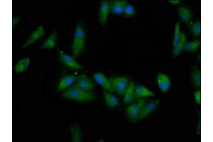 Immunofluorescence staining of Hela cells with ABIN7145566 at 1:200, counter-stained with DAPI. (EPRS Antikörper  (AA 1207-1399))
