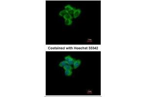 ICC/IF Image Immunofluorescence analysis of paraformaldehyde-fixed A431, using SENP2, antibody at 1:500 dilution. (SENP2 Antikörper  (N-Term))