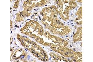 Immunohistochemistry of paraffin-embedded Human kidney using WBSCR22 Polyclonal Antibody at dilution of 1:100 (40x lens). (WBSCR22 Antikörper)