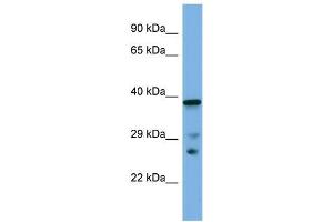 Host:  Rabbit  Target Name:  Lhx8  Sample Type:  Mouse Small Intestine lysates  Antibody Dilution:  1. (LHX8 Antikörper  (C-Term))