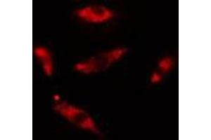 ABIN6275437 staining HuvEc cells by IF/ICC.