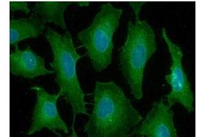ICC/IF analysis of PDCP1 in HeLa cells line, stained with DAPI (Blue) for nucleus staining and monoclonal anti-human PDCD1 antibody (1:100) with goat anti-mouse IgG-Alexa fluor 488 conjugate (Green). (PD-1 Antikörper  (AA 21-167))