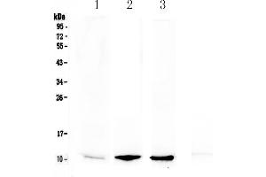 Western blot analysis of NAP2 using anti-NAP2 antibody . (CXCL7 Antikörper  (AA 40-113))