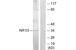 Western blot analysis of extracts from Jurkat cells, treated with serum (20%, 15mins), using NR1I3 antibody.