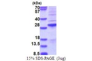 SSX2 Protein (AA 1-188) (His tag)
