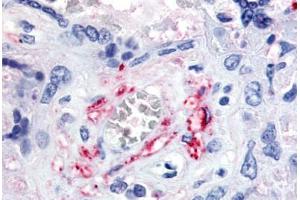 Human Placenta, Fetal Capillary Endothelial Cells (formalin-fixed, paraffin-embedded) stained with FLT1 antibody ABIN213617 at 5-10 ug/ml followed by biotinylated goat anti-rabbit IgG secondary antibody ABIN481713, alkaline phosphatase-streptavidin and chro . (FLT1 Antikörper  (N-Term))