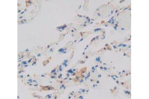 Immunohistochemistry (IHC) image for anti-Latent Transforming Growth Factor beta Binding Protein 1 (LTBP1) (AA 1424-1721) antibody (ABIN7443545)