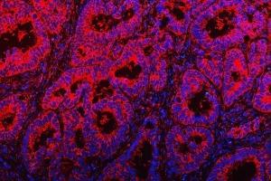 IF analysis of TOM1L1 using anti-TOM1L1 antibody (ABIN7602631). (TOM1L1 Antikörper  (AA 9-448))