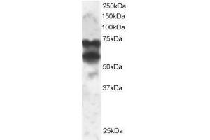 Image no. 1 for anti-Protein Phosphatase 2, Regulatory Subunit B', delta (PPP2R5D) (C-Term) antibody (ABIN374132) (PPP2R5D Antikörper  (C-Term))