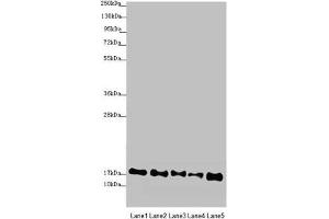 Western blot All lanes: ATP5F1D antibody at 2. (ATP5F1D Antikörper  (AA 1-168))