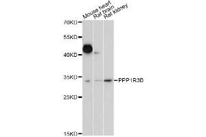 Western blot analysis of extracts of various cell lines, using PPP1R3B antibody (ABIN6293886) at 1:1000 dilution. (PPP1R3B Antikörper)
