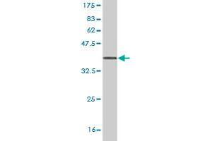 Western Blot detection against Immunogen (36. (UMPS Antikörper  (AA 381-479))