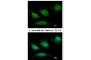 ICC/IF Image Immunofluorescence analysis of methanol-fixed HeLa, using DNA polymerase gamma, antibody at 1:200 dilution. (POLG Antikörper  (C-Term))