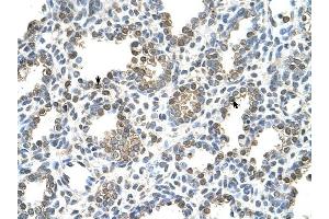 TST antibody was used for immunohistochemistry at a concentration of 4-8 ug/ml to stain Alveolar cells (arrows) in Human Lung. (TST Antikörper)