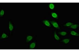 Immunofluorescent analysis of A549 cells using ABIN7150418 at dilution of 1:100 and Alexa Fluor 488-congugated AffiniPure Goat Anti-Rabbit IgG(H+L)