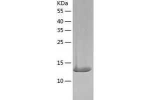 Western Blotting (WB) image for Actin Related Protein 2/3 Complex, Subunit 5, 16kDa (ARPC5) (AA 1-151) protein (His tag) (ABIN7121655)