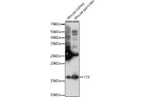 Western blot analysis of extracts of various cell lines, using TTR Rabbit mAb (ABIN1682449, ABIN3018489, ABIN3018490 and ABIN7101619) at 1:1000 dilution. (TTR Antikörper)