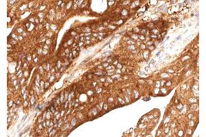 ABIN6268729 at 1/100 staining human Stomach tissue sections by IHC-P. (Cathepsin E Antikörper  (Internal Region))